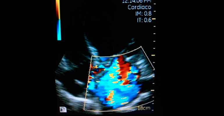 Ecocardiografías Doppler Color